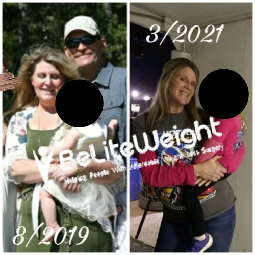 Shannon D - 2 Year Update*